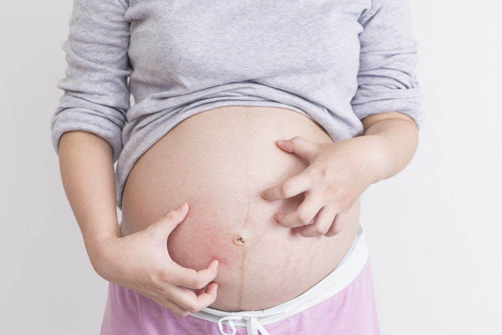 Mẹ bầu bị ngứa khi mang thai tháng cuối