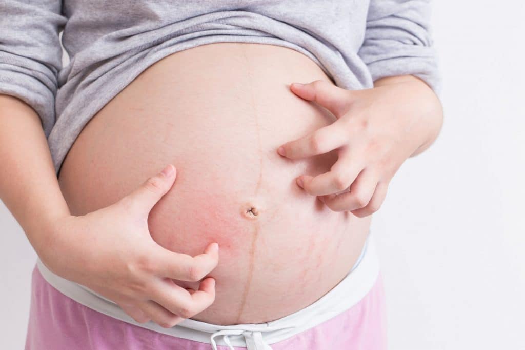 Ứ mật thai kỳ thường xảy ra vào những tháng cuối